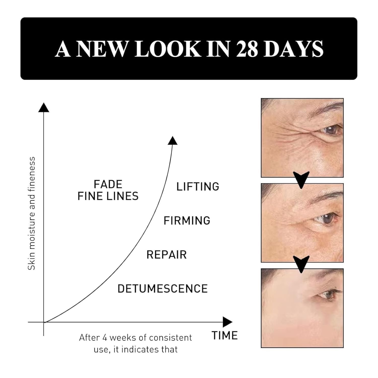 Eye Lift 